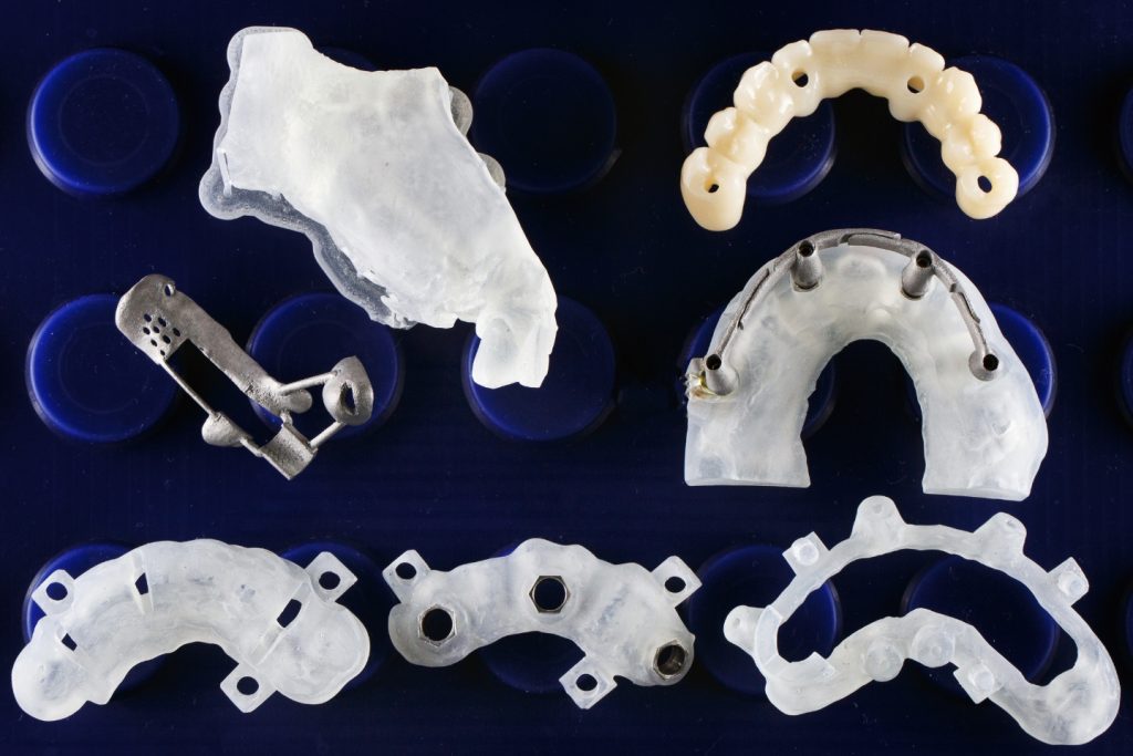 implantes cigomáticos